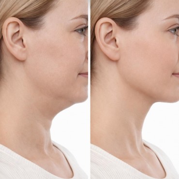 Lenfatik Drenaj Masaj Fırçası 