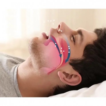 Horlama Önleyici Rahat Uyku Aparatı 